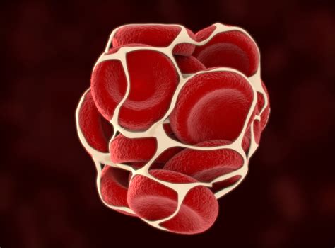 Your Complete Guide To Understanding Blood Clots Usa Vein Clinics