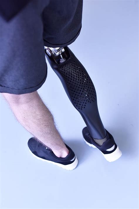 Customized 3d Printed Prosthetic Leg Cover Design By Tomas Vacek