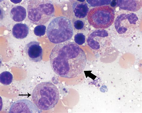 Cytological Bone Marrow Cell Differential Counts And Morphologic