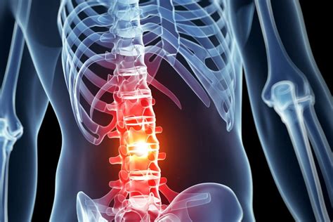 Spinal Cord Injury Symptoms And Causes Miosuperhealth