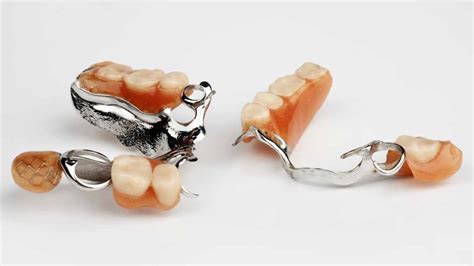 Flipper Tooth Temporary Partial Denture All You Need To Know