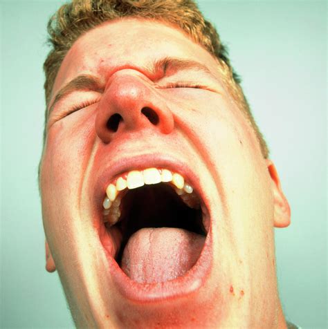 Face Of A Man Screaming In Pain Or Rage Photograph By Sheila Terry Science Photo Library Pixels