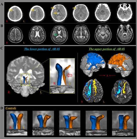 Brain Ct Images Magnetic Resonance Images And Diffusion Tensor