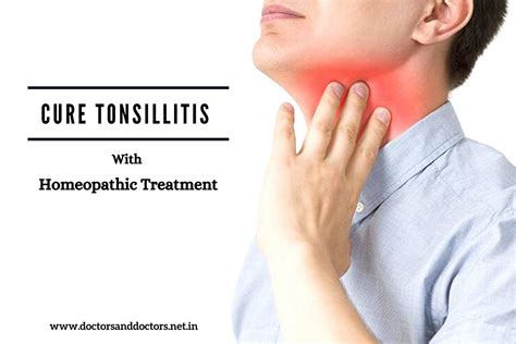 Cure Tonsillitis With Appropriate Homeopathic Treatment By Soumis