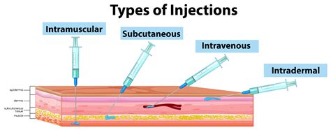 Types Of Injection Presentation