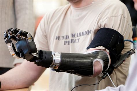醫療生科 新機械義肢有如真手，可以大腦控制 Technews 科技新報
