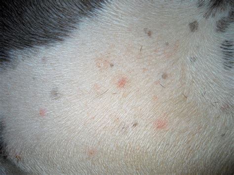 Image Gallery Primary Skin Lesions Clinician S Brief