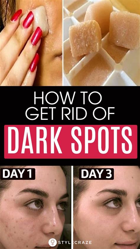 how to remove dark spots on face very fast howtormeov