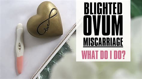 Blighted Ovum Miscarriage What Do I Do Next Youtube