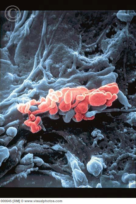 Mycoplasma Pneumoniae On Cultured Cells Pleomorphic Organisms Lacking