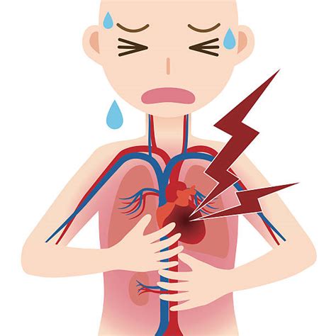Heart Attack Clip Art Vector Images And Illustrations Istock