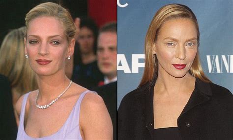 Uma Thurman Looks Decidedly Different At The Slap Premiere Hair Implants Celebrity Beauty