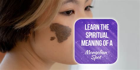 15 Mongolian Spot Spiritual Meanings Explained Simply Symbolism