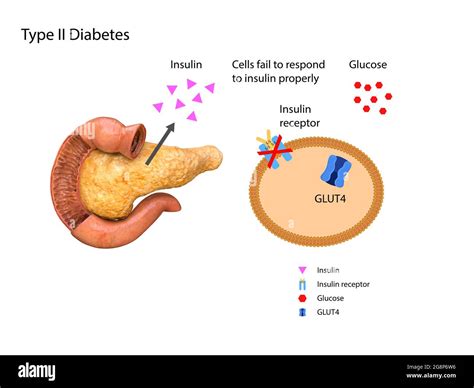 Schematic Illustration Of The Pancreas And Stomach In Insulin Levels