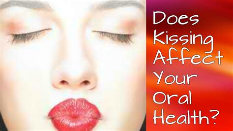 Does Kissing Affect Your Oral Health Dentist In Bounds Green