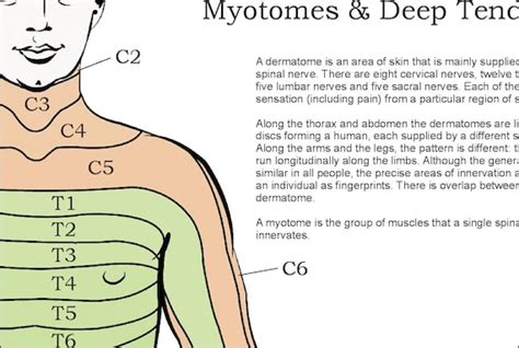 Printable Dermatome Chart Dermatomes Myotomes And Dtr Poster X Chiropractic Medical Chart