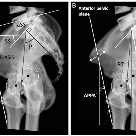 measurement of pelvic parameters anatomical ss a and anatomical pt download scientific