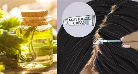 Antifungal Remedies For Hair Yeast Infection Fungus Therapy