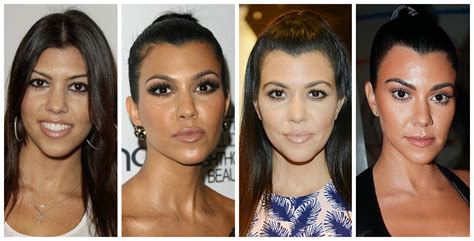 Kim Kardashian Eye Bag Surgery