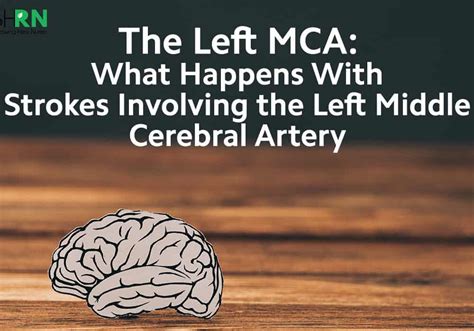 What Happens With Strokes Involving The Left Middle Cerebral Artery