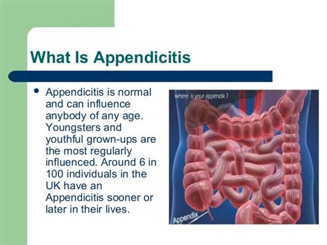 Where Is Your Appendix