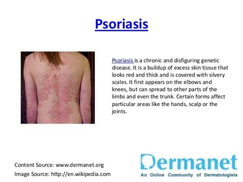 Common Skin Diseases Brought To You By Dermanet