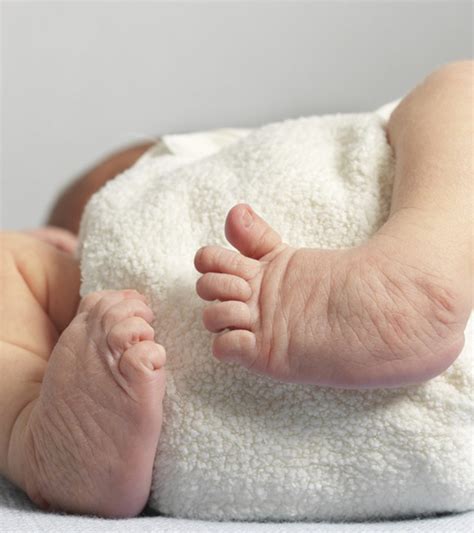 What Causes Clubfoot In Babies And Whats The Treatment Baby Care Guide
