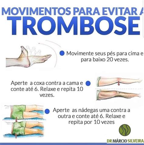 Como prevenir a trombose Pacientes do Dr Márcio Silveira