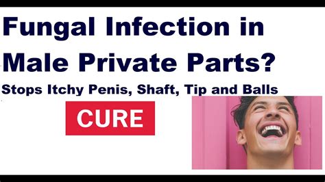 Best Medicine For Fungal Infection In Male Private Parts Youtube