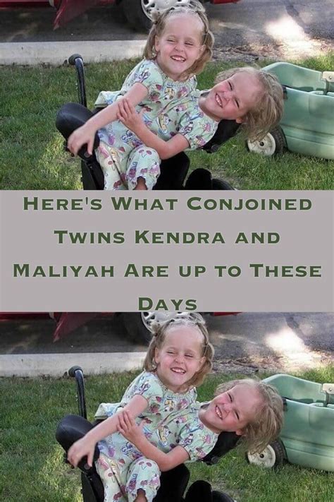 conjoined twins celebrity facts style mistakes birthday t baskets celebrites positive