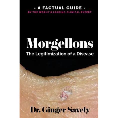 Morgellons The Legitimization Of A Disease A Factual Guide By The