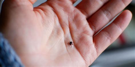 How To Spot And Treat A Tick Bite — And What To Do You If You Have A