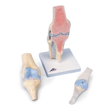 Sectional Knee Joint Model 3 Part