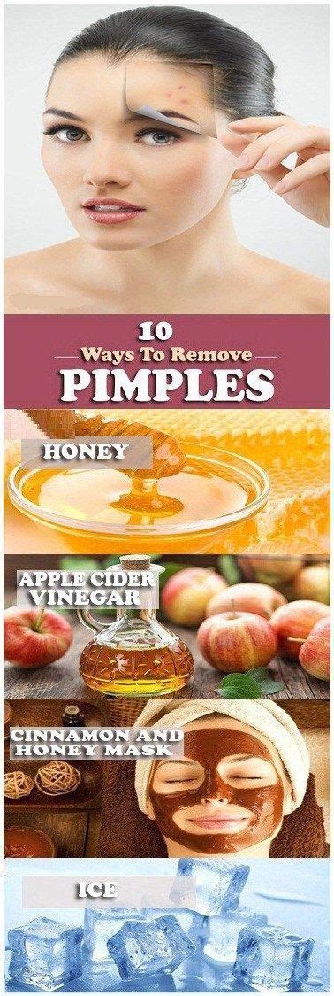 10 Effective And Simple Home Remedies For Pimples Info Health Tips