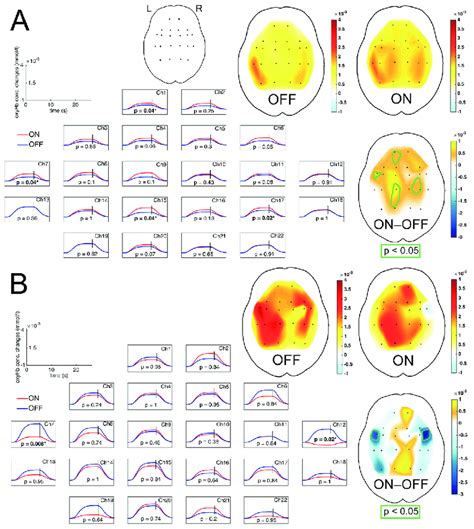 Nirs Brain Mapping Map Of Average Concentration Changes Oxygenated
