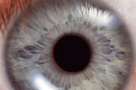 Symptoms Causes And Treatment Of A Corneal Abrasion