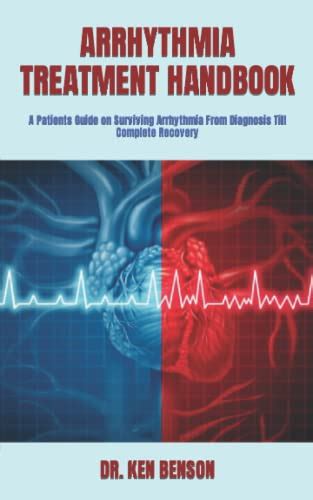 Arrhythmia Treatment Handbook A Patients Guide On Surviving Arrhythmia From Diagnosis Till