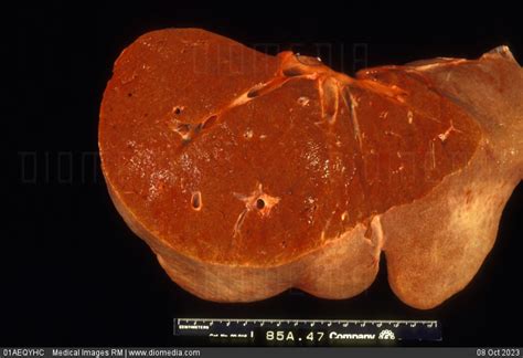 Stock Image Gross Anatomy Of A Normal Liver Cut In Half 17928
