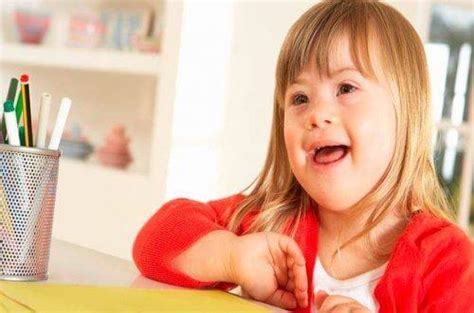 Raising A Child With Down Syndrome Step To Health