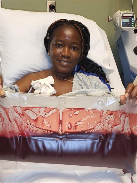 Upstate Mom Battling Sickle Cell Anemia Needs Monthly Full Blood Exchanges