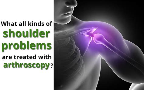 Types Of Problems Are Treated With Shoulder Arthroscopy Hbg Medical