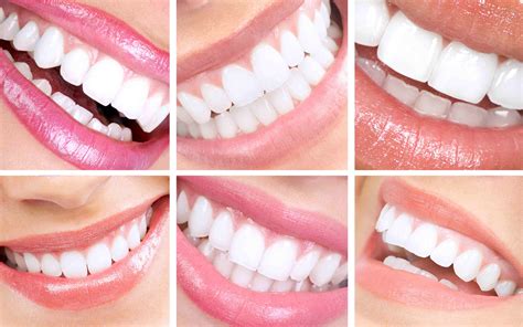 Smile Designs Aesthetic Dental Zone