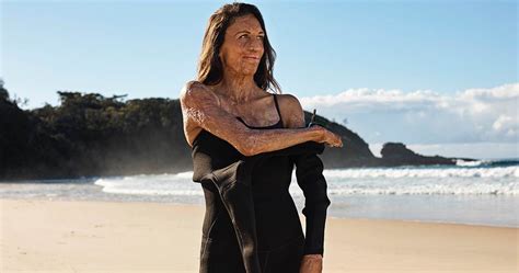 Turia Pitt Shares Inspirational Message in Strong Sensitive Campaign from Avène
