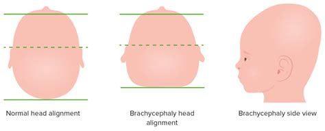 Head And Neck Examination Concise Medical Knowledge