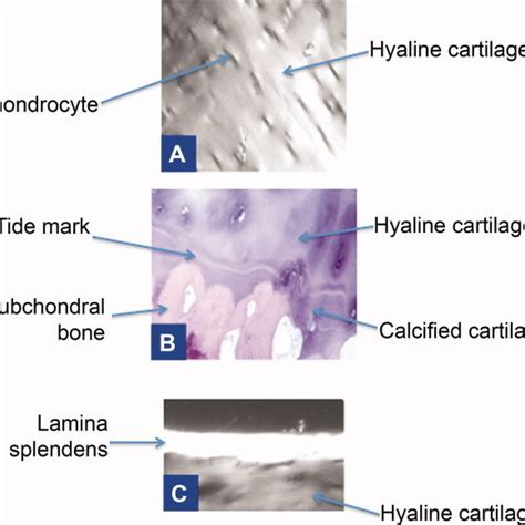 Diagram Of The Microstructure Of Articular Cartilage Found In The