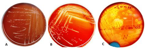 Brucella Pinnipedialis Reference Strain Cultivated On Blood Agar
