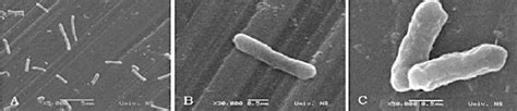 Scanning Of Electron Micrographs Of Salmonella Enteritidis Cells