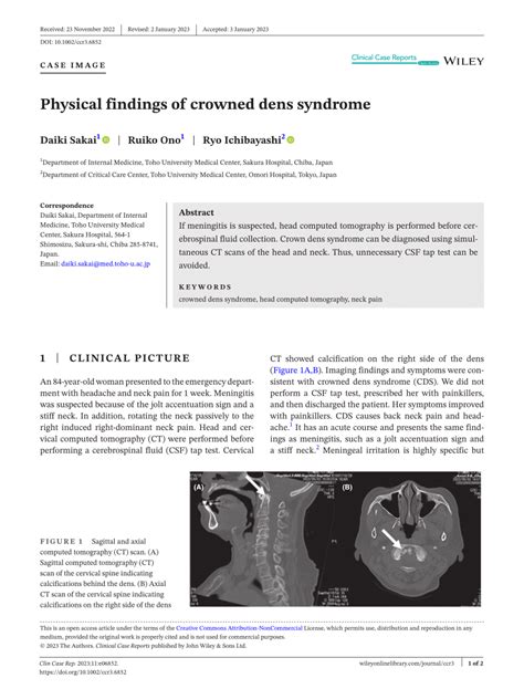 Pdf Physical Findings Of Crowned Dens Syndrome