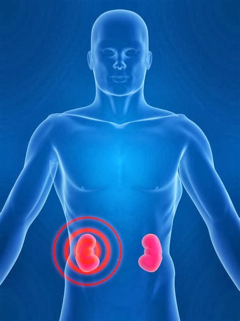Signs And Symptoms Signs And Symptoms Of Acute Renal Failure