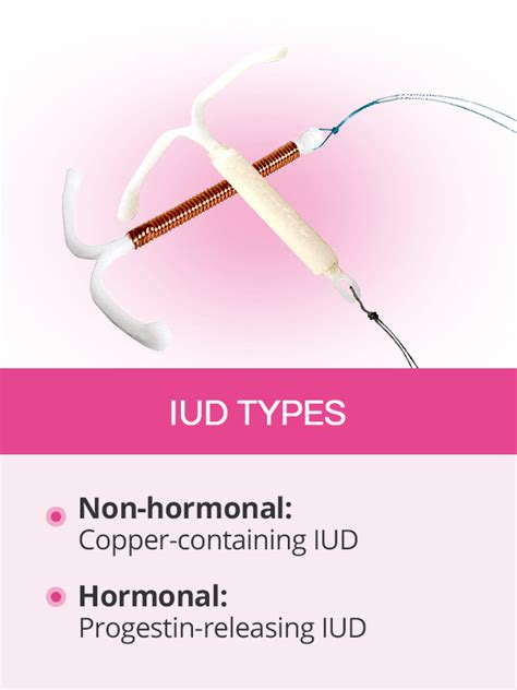 Iud Types There Are 5 Types Of Iuds Heres How To Choose The Best